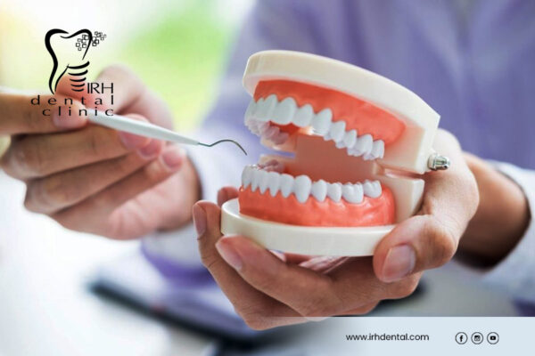 Root-Canal-Treatment-Services