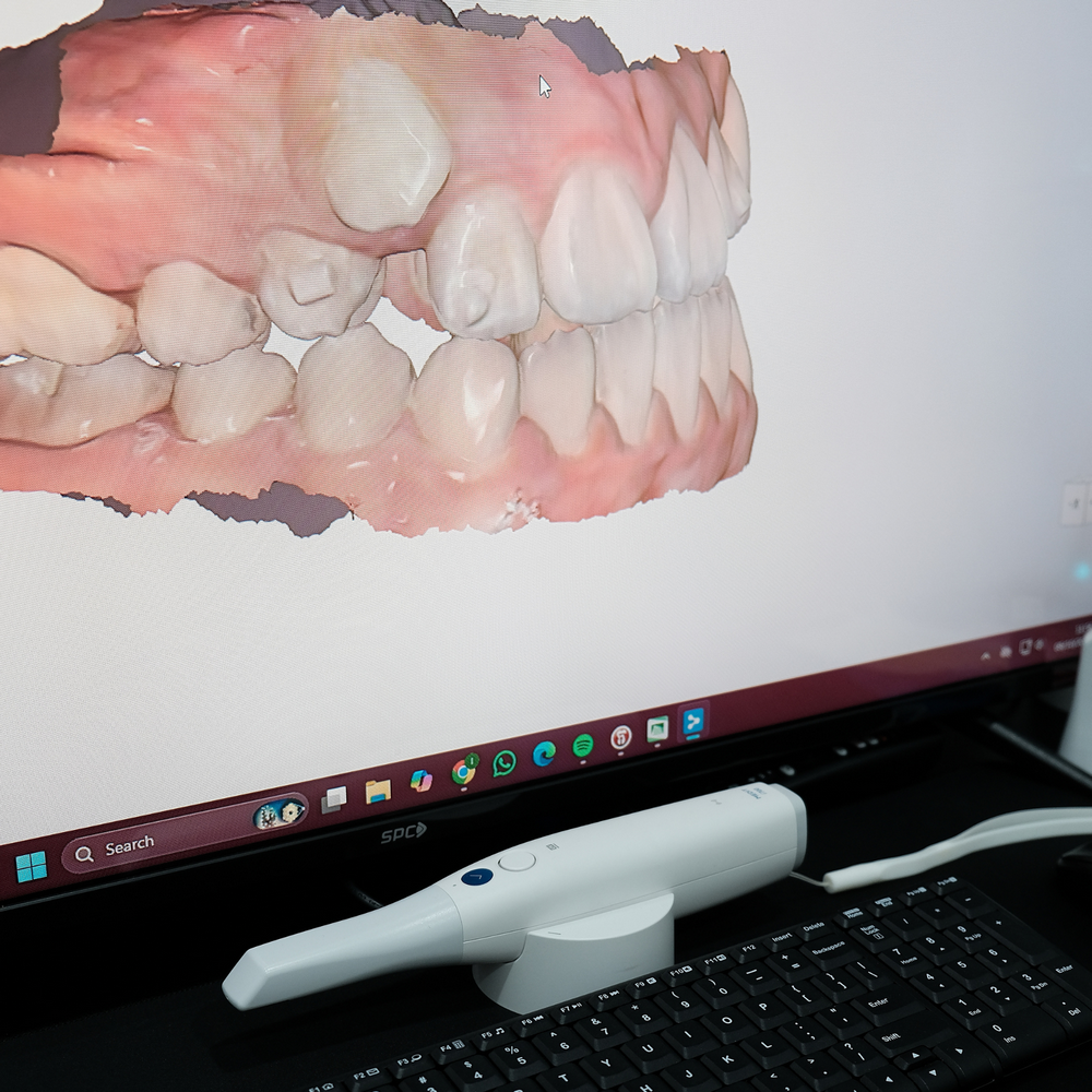 facility - 3D Intraoral Scanner