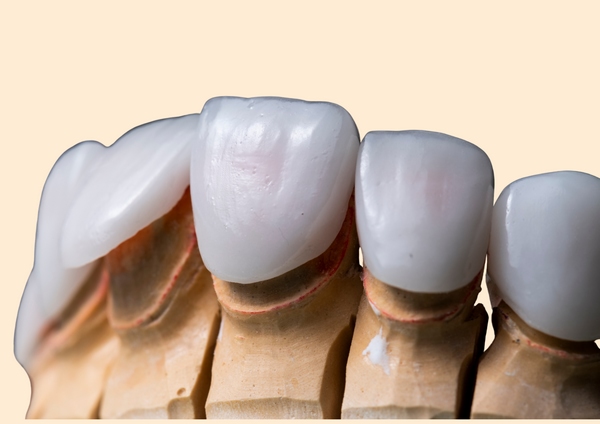 Zirconia / Porcelain Veneers